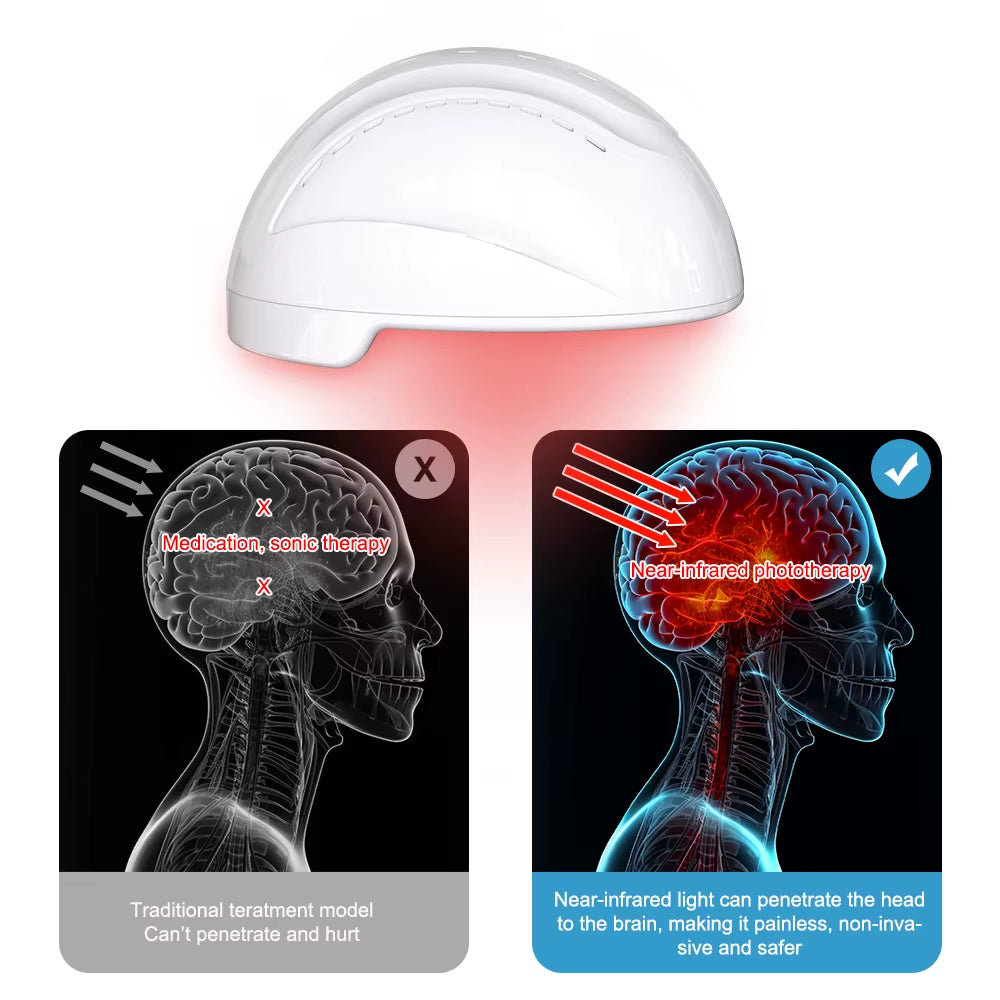 Physiotherapy 810Nm Infrared Light Therapy Brain Helmet Relaxation Treatment Helmet for Autism Relief